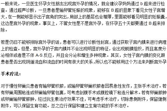 做B超檢查可以測出是不是宮外孕嗎？