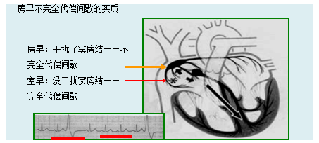 房性期前收縮的心電圖特點