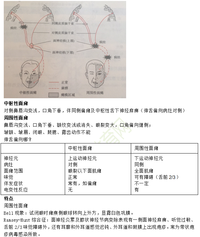 中樞性面癱與周圍性面癱